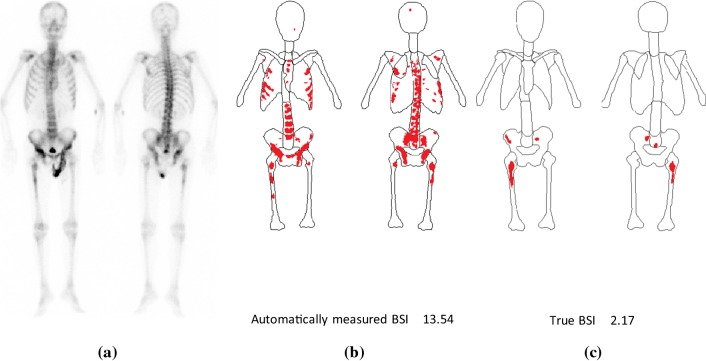 Fig. 11