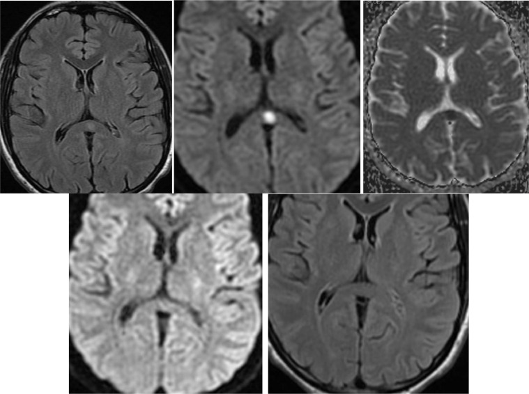 Fig 1