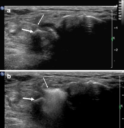 Fig. 4