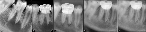 Figure2