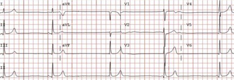 Figure 1