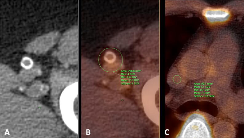 Figure 1