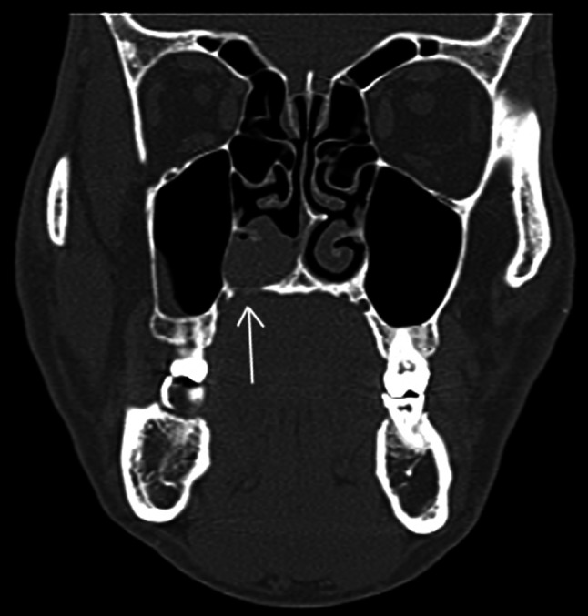 Fig. 7