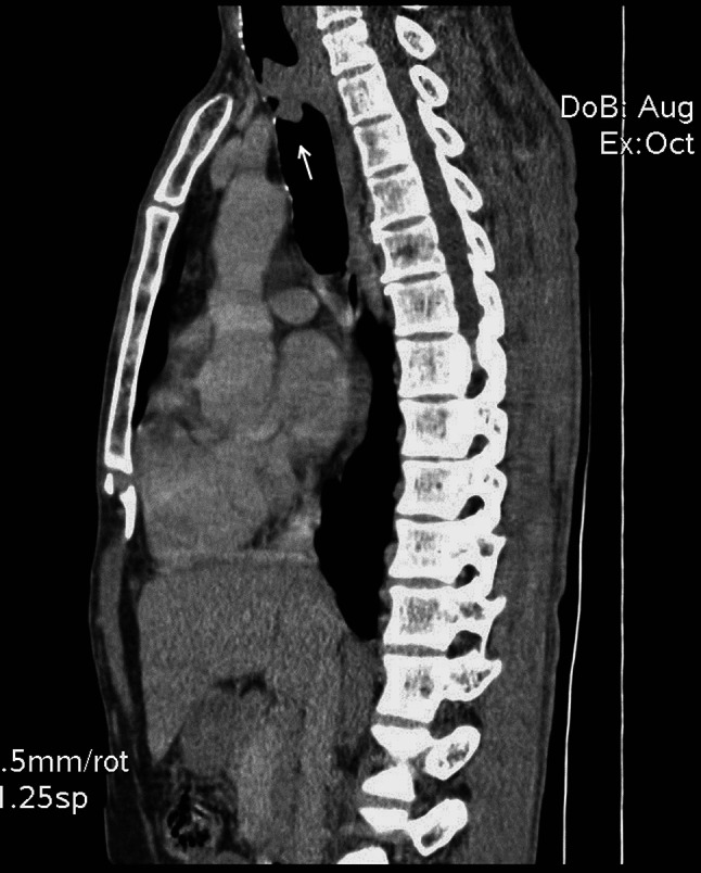 Fig. 1