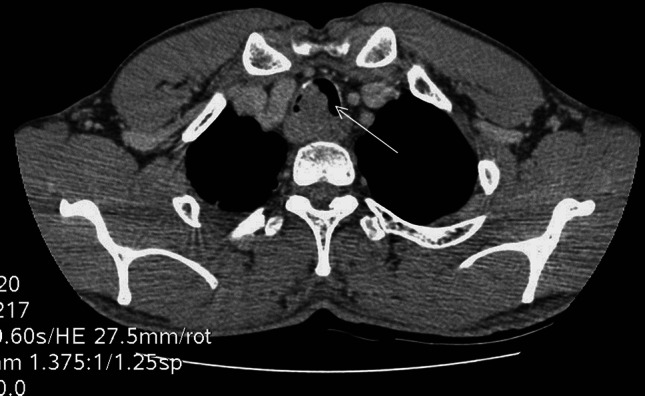 Fig. 2