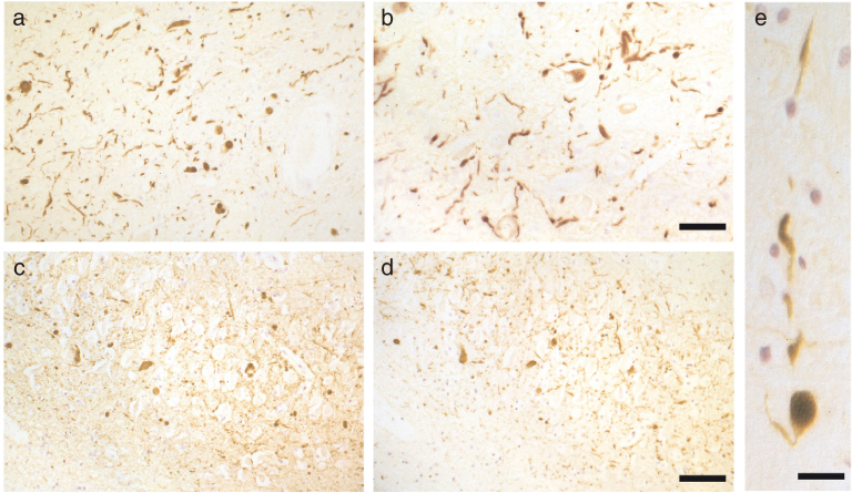 Fig.4