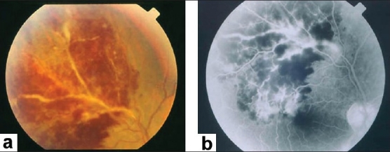 Figure 16