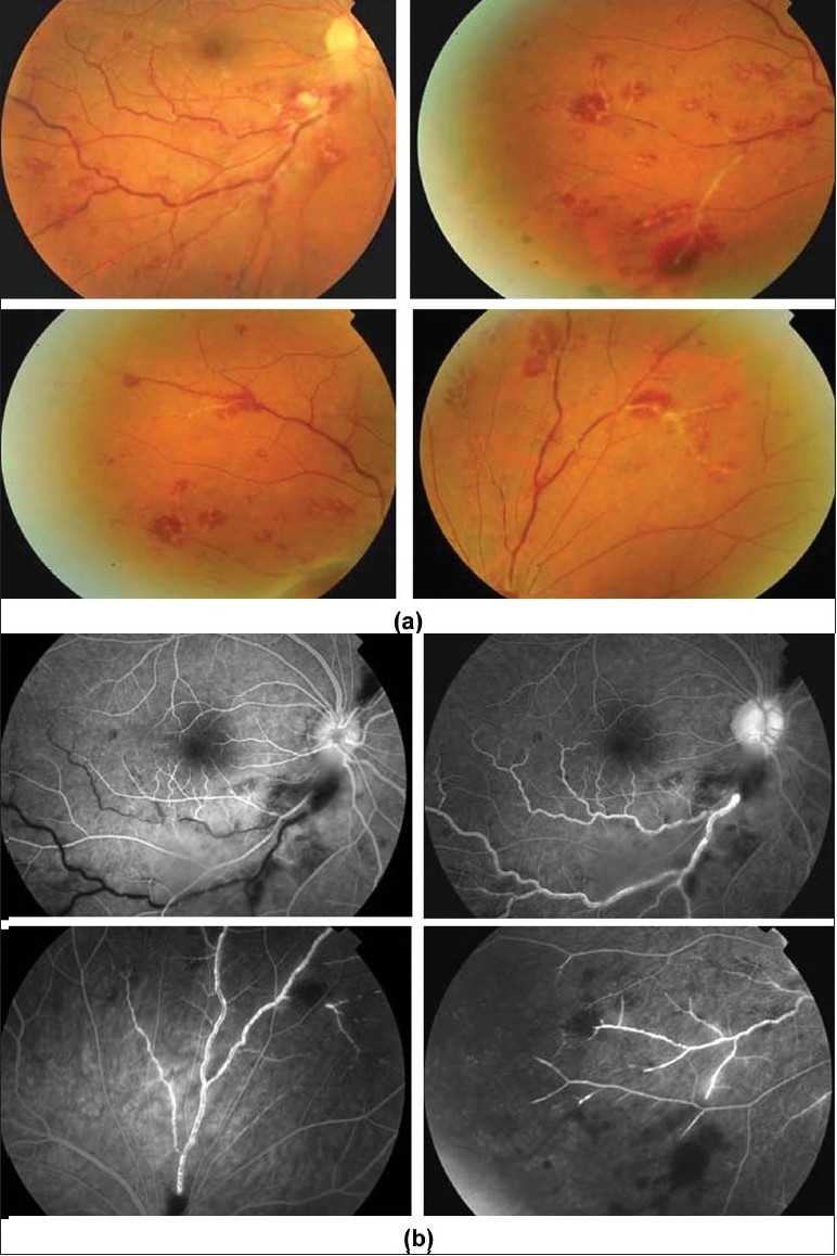 Figure 23