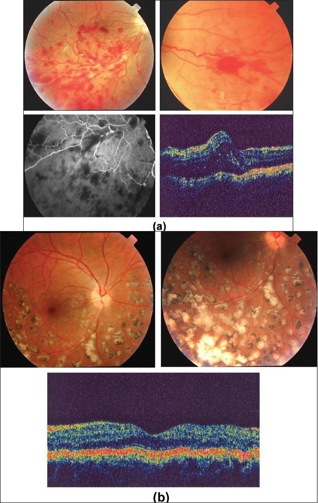 Figure 21