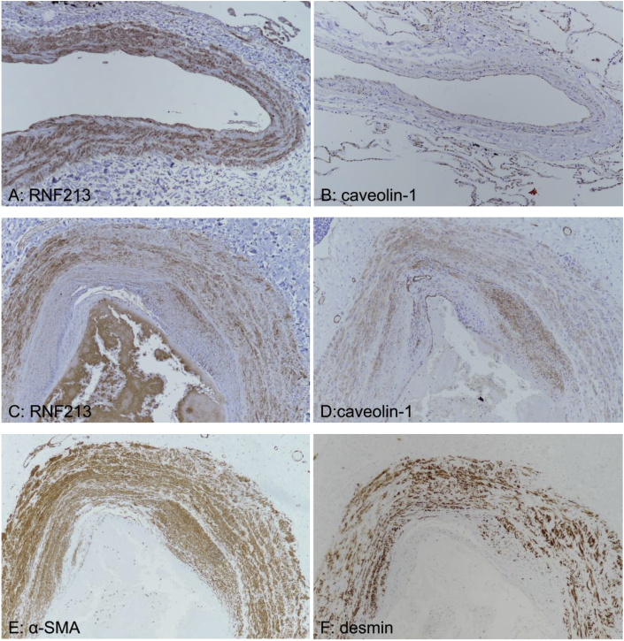 Fig. 10