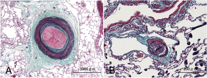 Fig. 7