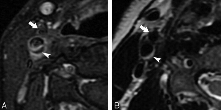 Fig 3.