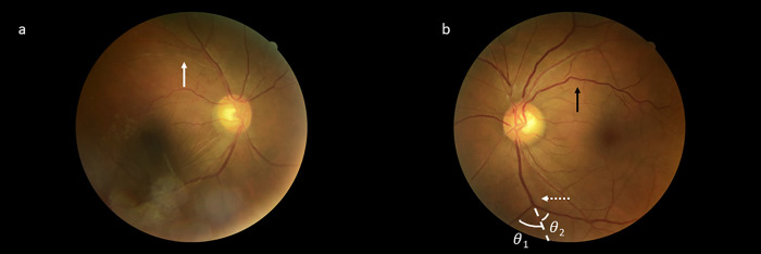 Fig 3