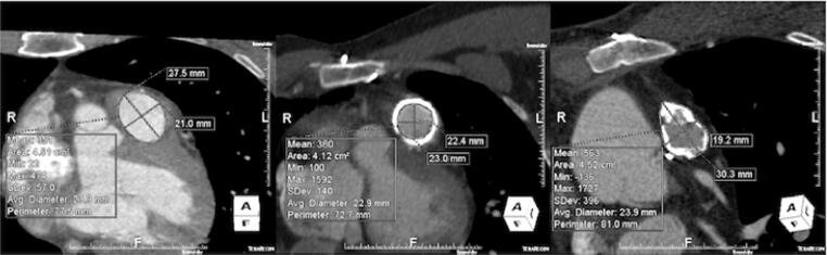 Fig. 2