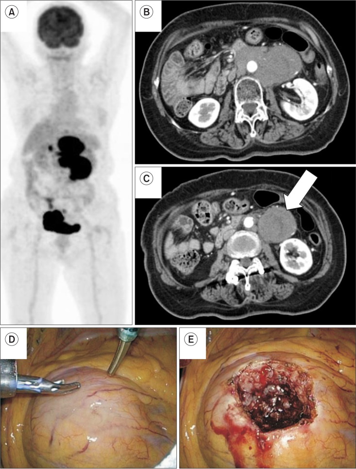 Fig. 2