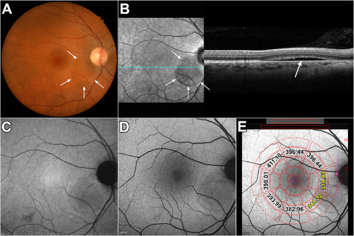 Figure 3.