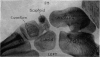245