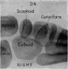 245