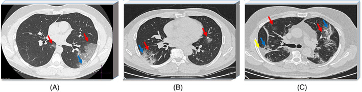 FIGURE 1