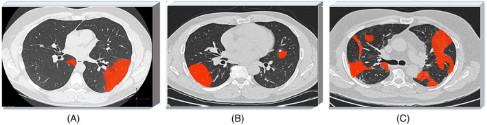 FIGURE 2