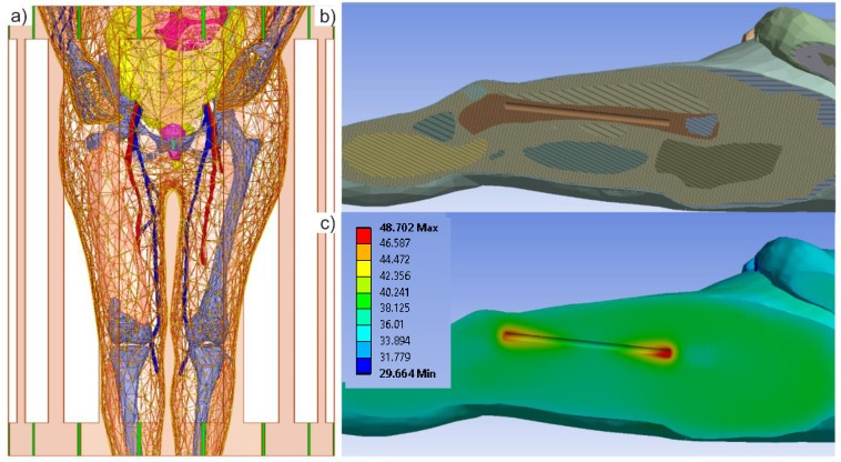 Fig 4