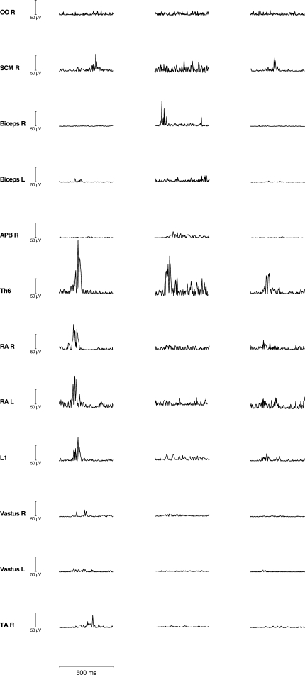 Fig. 2