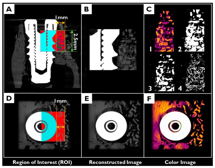 Figure 14