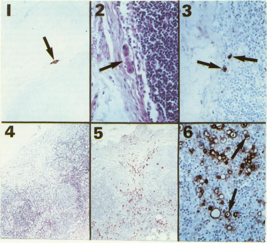 Figures 1-6