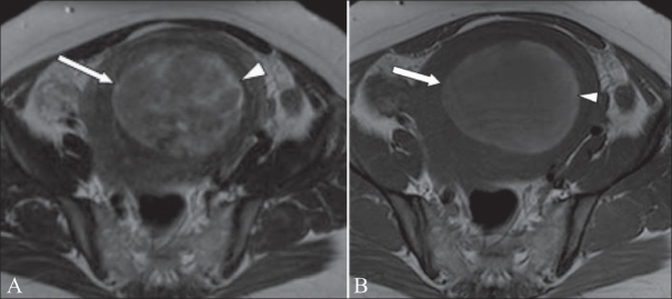 Figure 13 (A, B)