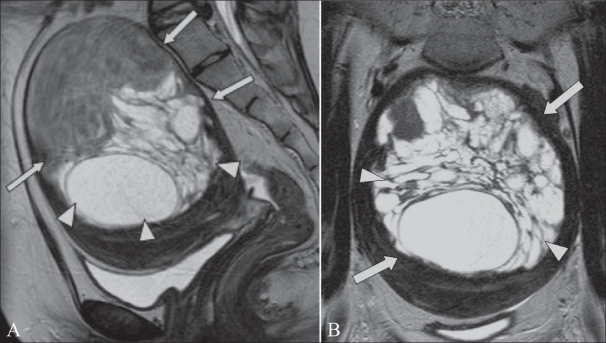 Figure 12 (A, B)