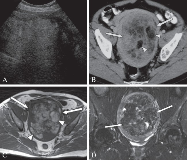 Figure 15 (A-D)