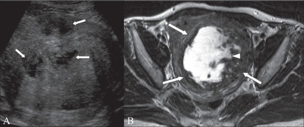 Figure 7 (A, B)