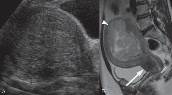 Figure 5 (A, B)