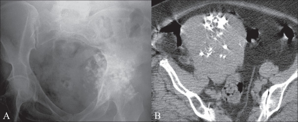 Figure 4 (A, B)