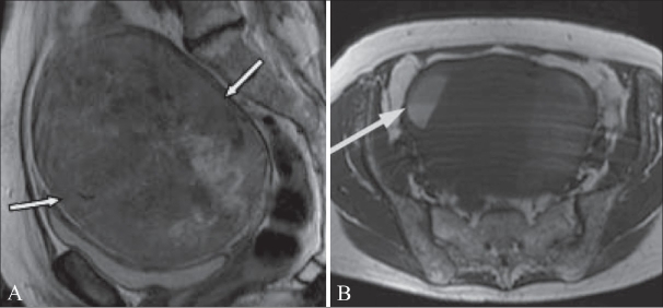 Figure 16 (A,B)