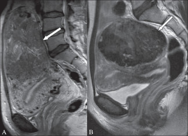 Figure 10 (A, B)