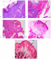 Fig. 17