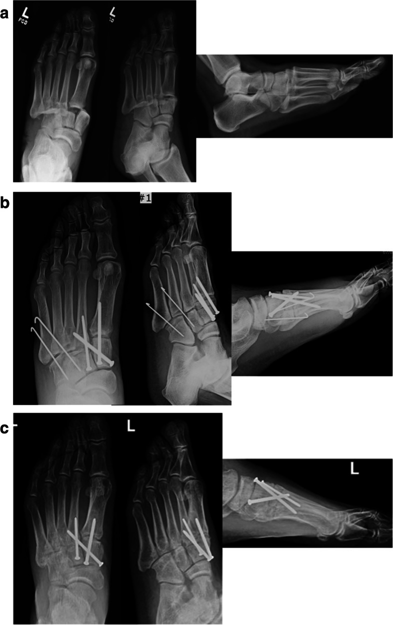 Fig. 3