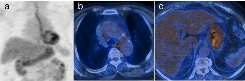 Fig. 1