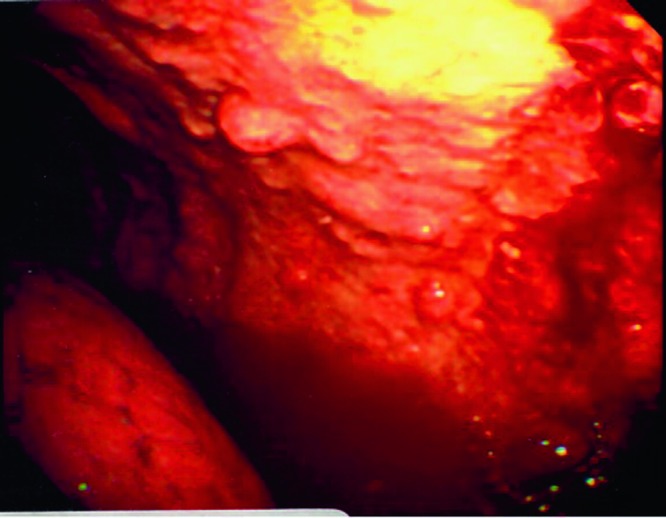 Fig. 64.6