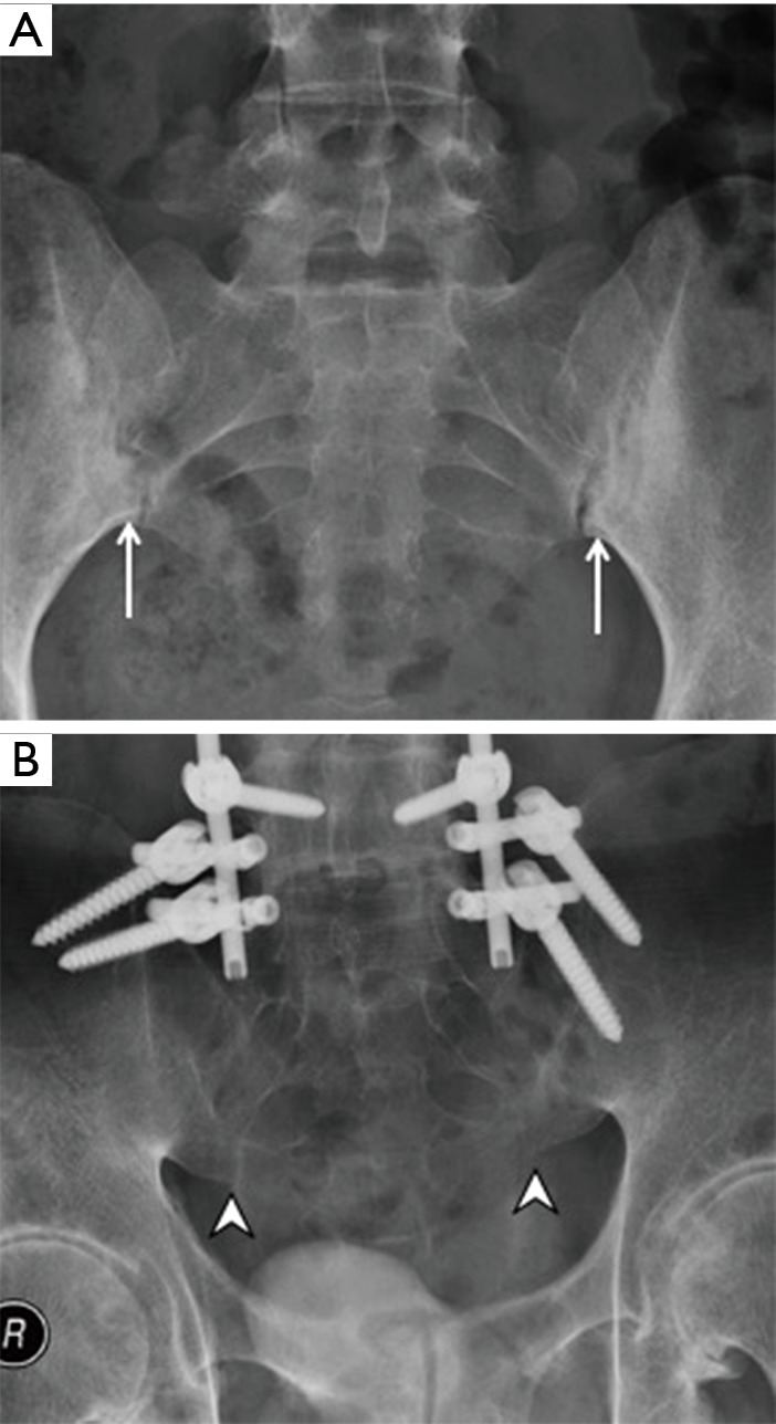 Figure 16