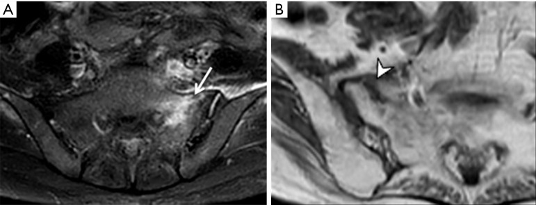 Figure 22