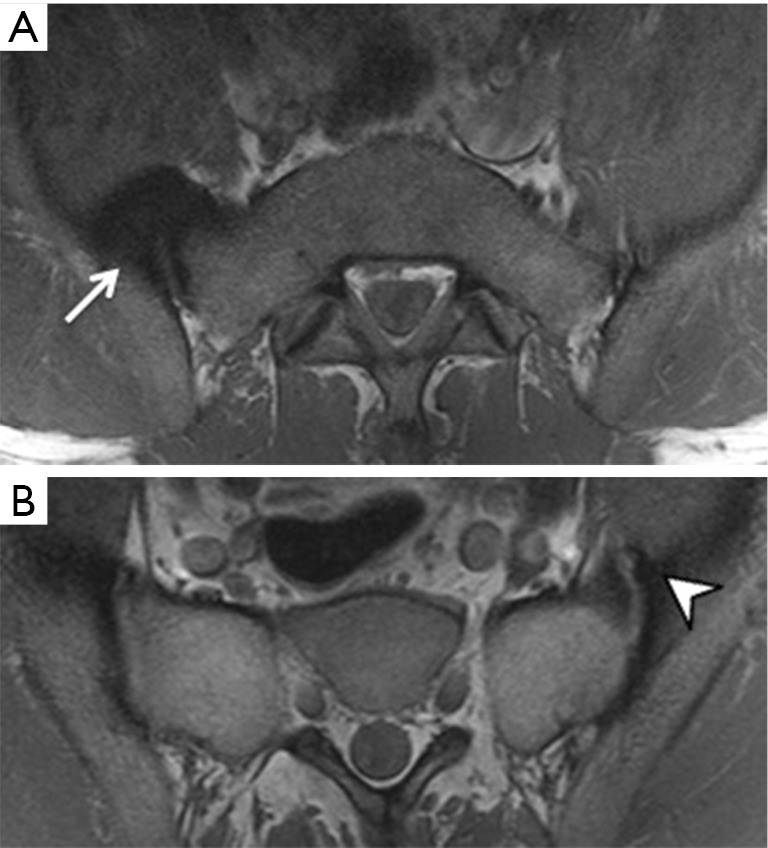 Figure 21