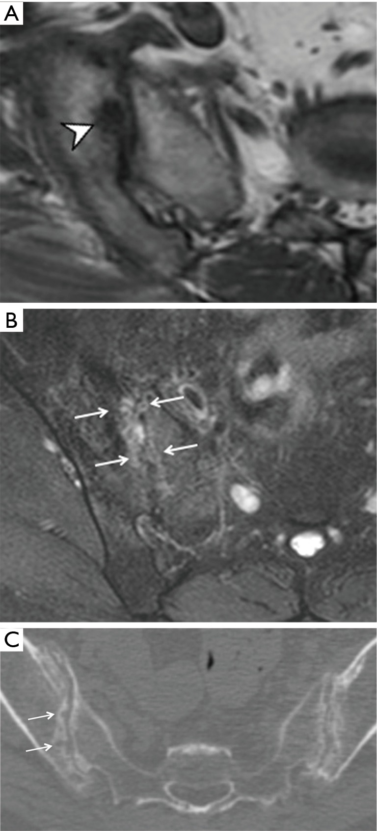 Figure 14