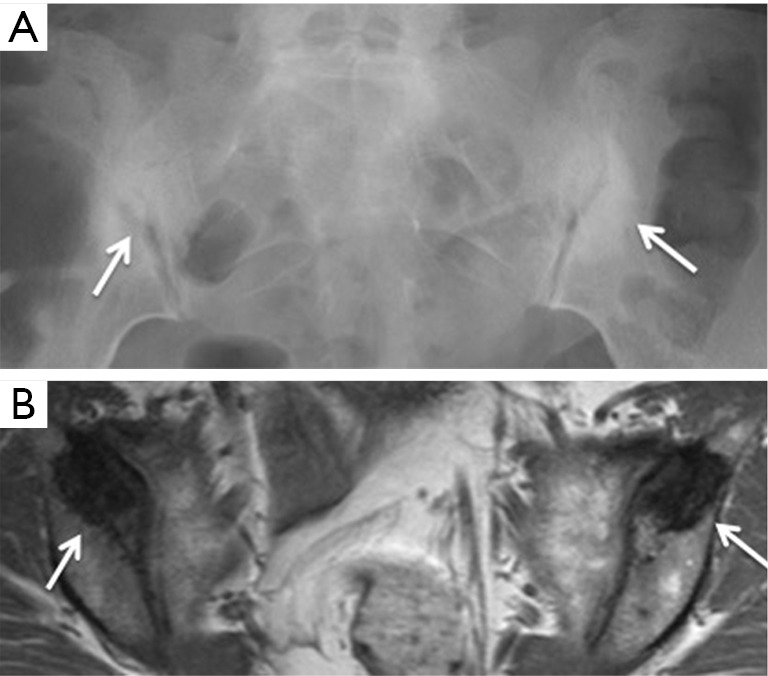 Figure 23