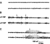 FIG. 11.