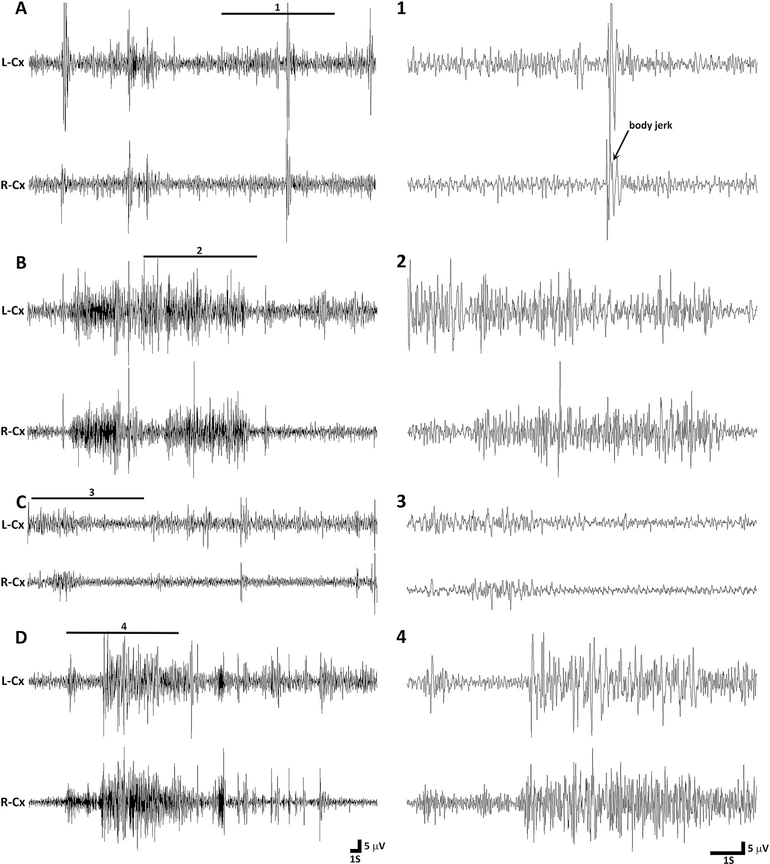 Fig. 2.