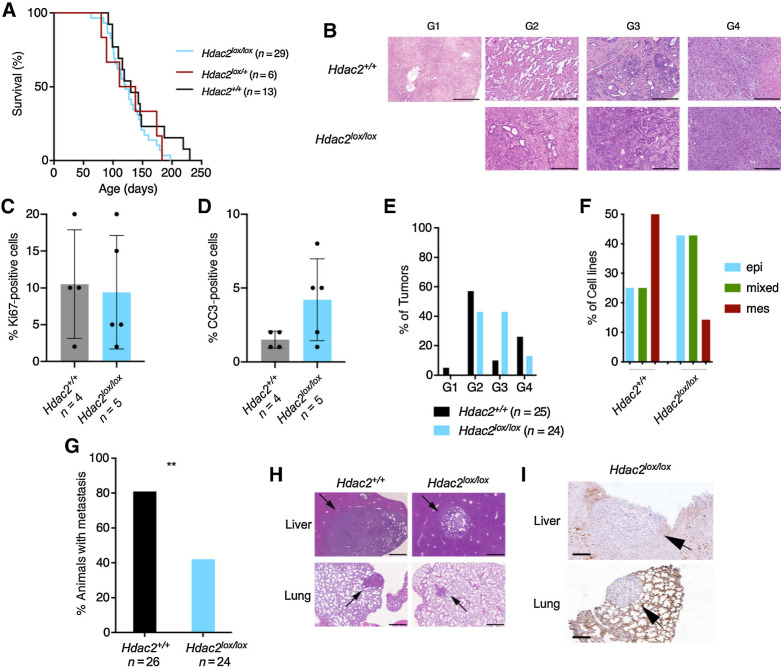 Figure 3. HDAC2 controls a route to metastasis in vivo. A, Kaplan–Meier plots of KPC (black), KPCH2lox/+(red), and KPCH2lox/lox (blue) mice. B, Hematoxylin and eosin staining of murine PDAC from KPC and KPCH2lox/lox mice. G1, well-differentiated; G2, moderately differentiated; G3, poorly differentiated; G4, undifferentiated PDAC. Scale bar, 500 μm. C and D, Quantification of Ki67 stainings (C) and cleaved caspase-3 (D) stainings in murine PDAC from KPC (n = 4) and KPCH2lox/lox (n = 5) mice. E, Quantification of gradings from KPC and KPCH2lox/lox mice. F, Morphology of murine PDAC cell lines from KPC (n = 8) and KPCH2lox/lox mice (n = 7) was evaluated and stratified as epithelial (epi; blue), mesenchymal (mes; red), or as intermediate/mixed (mixed; green). G, Metastasis frequency of KPC and KPCH2lox/lox mice. **, P < 0.01 (Fisher exact test). H, Hematoxylin and eosin staining of liver and lung metastasis of KPC and KPCH2lox/lox mice. Scale bar, 500 μm. I, HDAC2 IHC of liver and lung metastasis of KPCH2lox/lox mice. Scale bar, 200 μm.