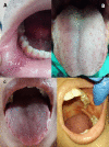 Fig. 2