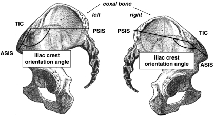 Fig. 12